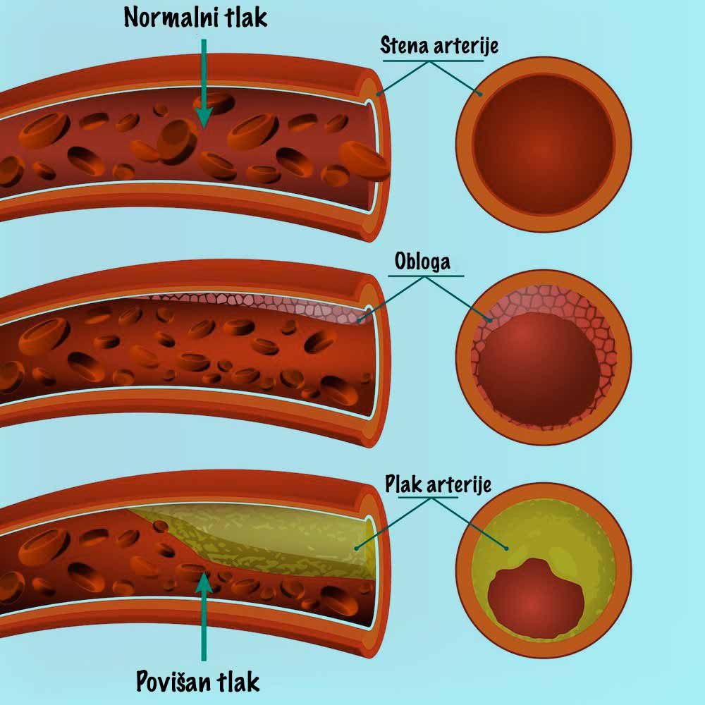 blood-pressure-display